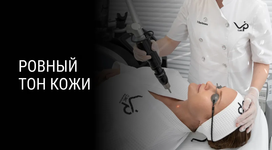 Лечение пигментации на аппарате PicoSure