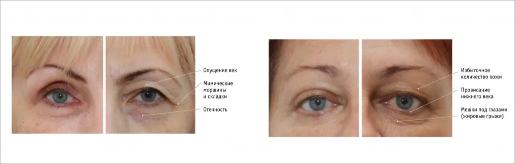 Before_After_1.jpg