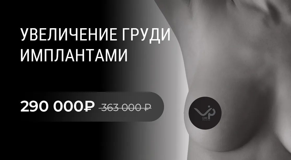 Маммопластика: увеличение груди за 290 000 р.